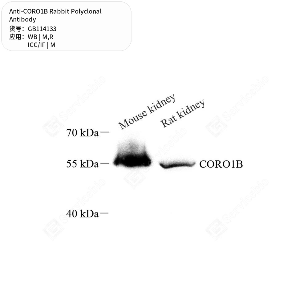 Антитела первичные, поликлональные кролика к CORO1B крысы, мыши, 100 мкл
