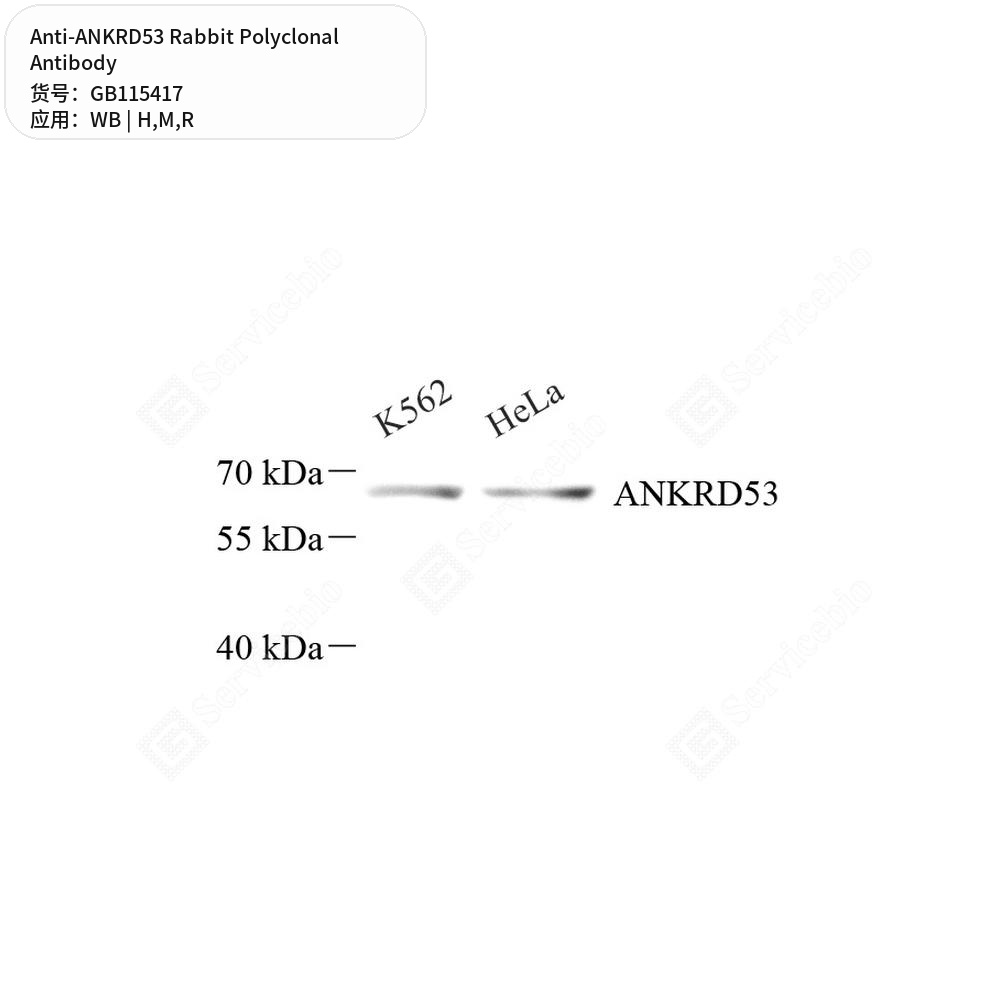 Антитела первичные, поликлональные кролика к ANKRD53 крысы, мыши, человека, 100 мкл
