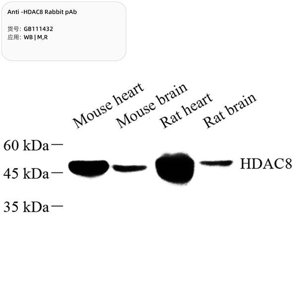 Антитела первичные, поликлональные, HDAC8, 100 мкл