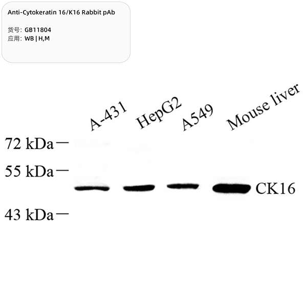 Антитела первичные, поликлональные, Cytokeratin 16/K16, 100 мкл