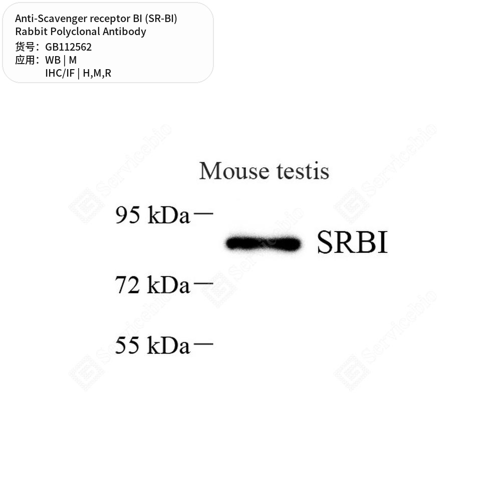 Антитела первичные, поликл. кролика к Scavenger receptor BI (SR-BI) крысы, мыши, человека, 100 мкл
