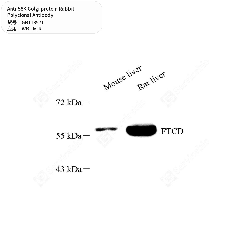 Антитела первичные, поликлональные кролика к 58K Golgi protein крысы, мыши, 100 мкл