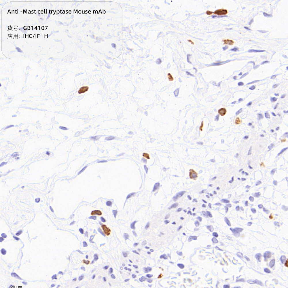 Антитела первичные, моноклональные мыши к Mast cell tryptase человека, 50 мкл