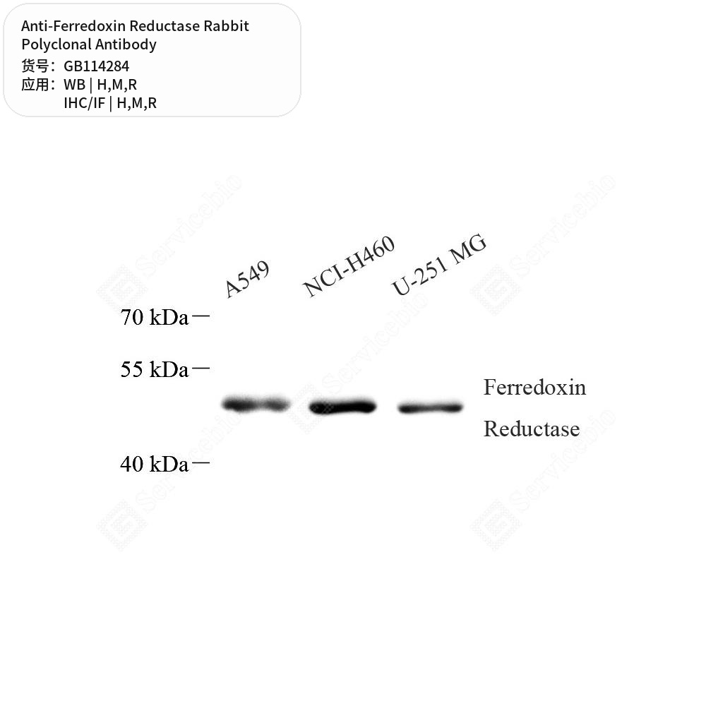 Антитела первичные, поликлональные кролика к Ferredoxin Reductase крысы, мыши, человека, 100 мкл