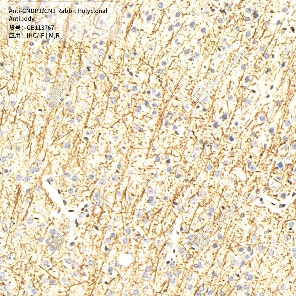 Антитела первичные, поликлональные кролика к CNDP1/CN1 крысы, мыши, 100 мкл