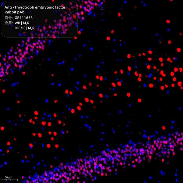 Антитела первичные, поликлональные, Thyrotroph embryonic factor, 100 мкл