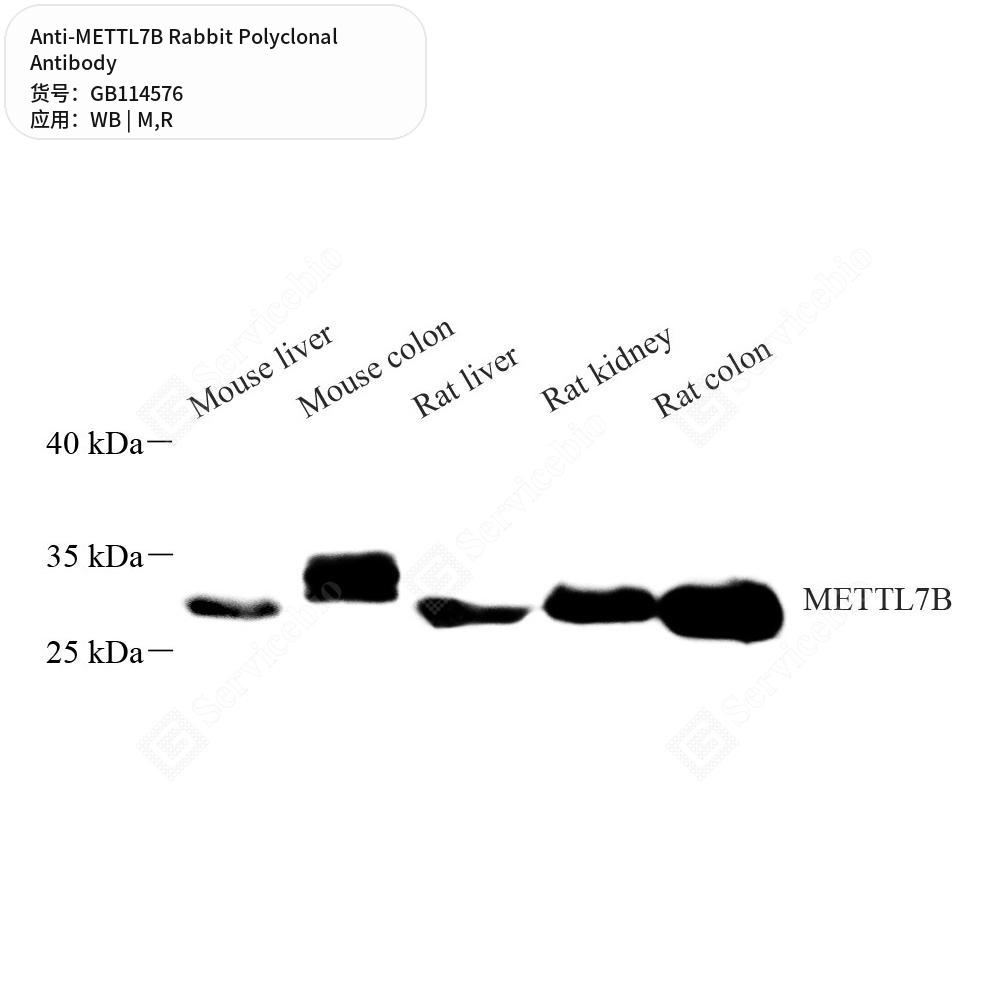 Антитела первичные, поликлональные кролика к METTL7B крысы, мыши, 100 мкл
