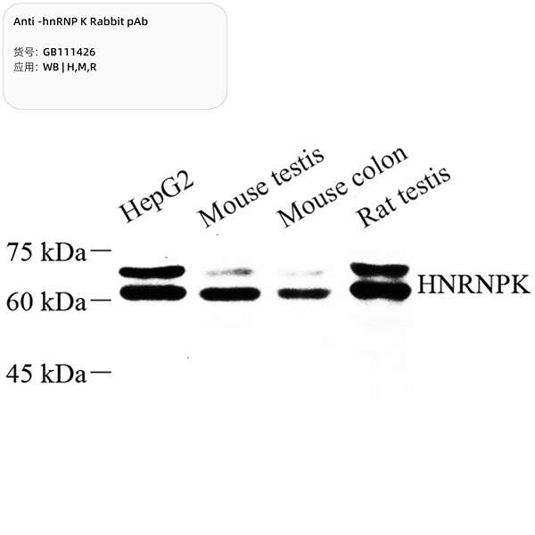 Антитела первичные, поликлональные, hnRNP K, 100 мкл