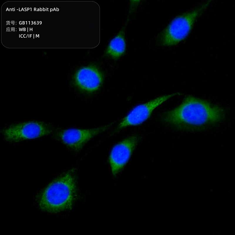 Антитела первичные, поликлональные, LASP1, 100 мкл