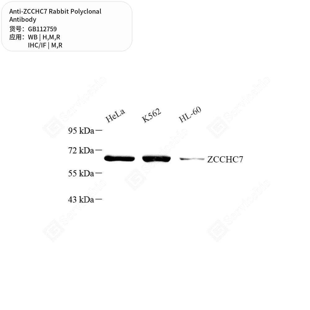 Антитела первичные, поликлональные кролика к ZCCHC7 крысы, мыши, человека, 50 мкл
