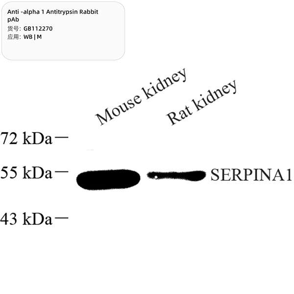 Антитела первичные, поликлональные, alpha 1 Antitrypsin, 100 мкл