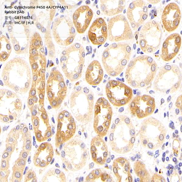 Антитела первичные, поликлональные, Cytochrome P450 4A/CYP4A11, 100 мкл