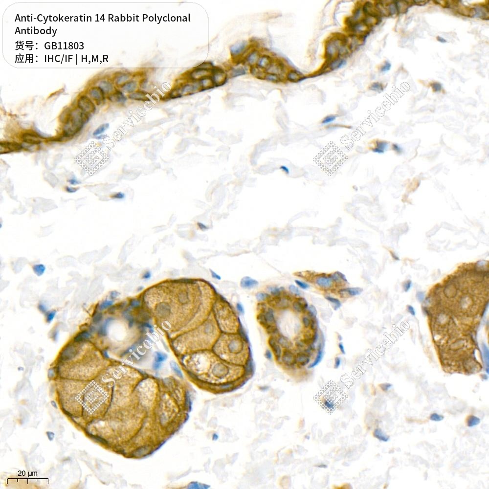 Антитела первичные, поликлональные кролика к Cytokeratin 14 крысы, мыши, человека, 100 мкл
