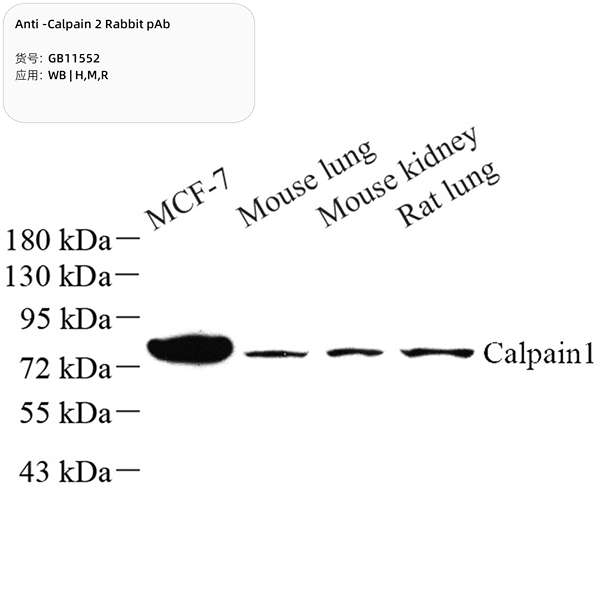 Антитела первичные, поликлональные, Calpain 2, 100 мкл