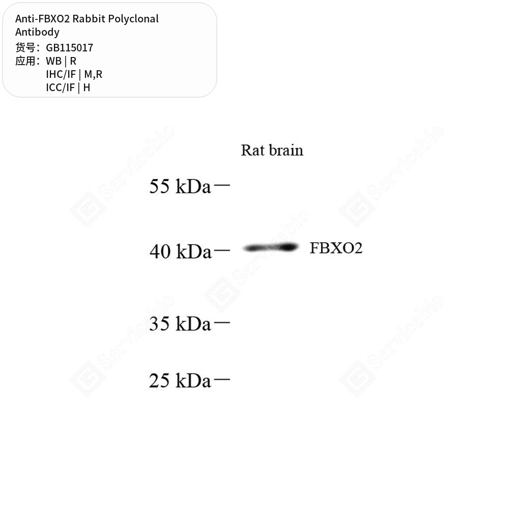 Антитела первичные, поликлональные кролика к FBXO2 крысы, мыши, человека, 50 мкл