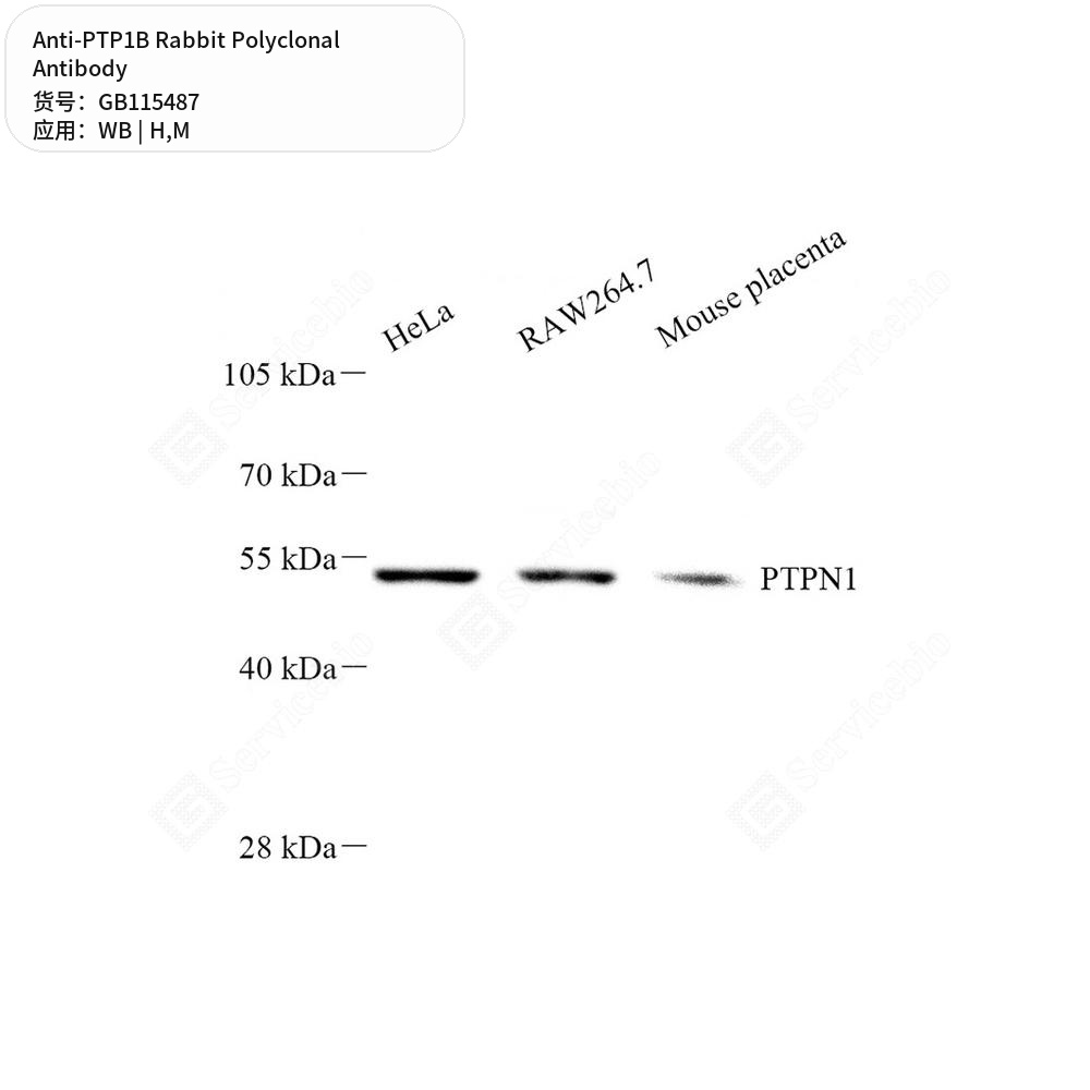 Антитела первичные, поликлональные кролика к PTP1B мыши, человека, 50 мкл
