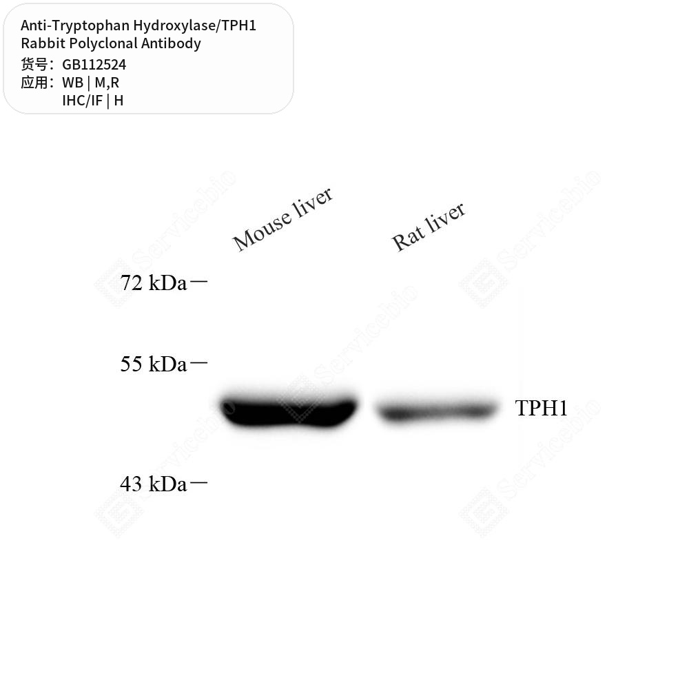 Антитела первичные, поликл. кролика к Tryptophan Hydroxylase/TPH1 крысы, мыши, человека, 100 мкл