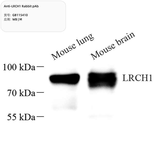 Антитела первичные, поликлональные, LRCH1, 100 мкл