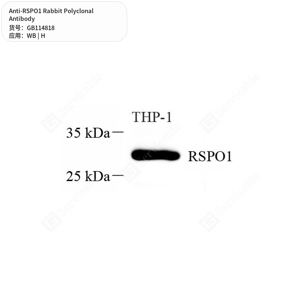 Антитела первичные, поликлональные кролика к RSPO1 человека, 50 мкл