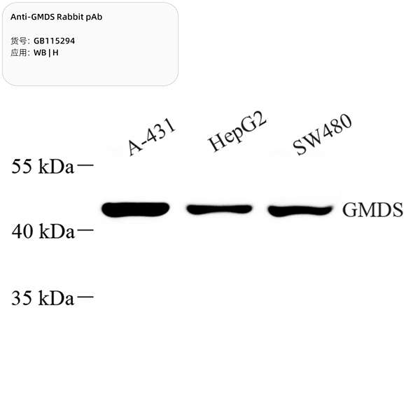 Антитела первичные, поликлональные, GMDS, 100 мкл