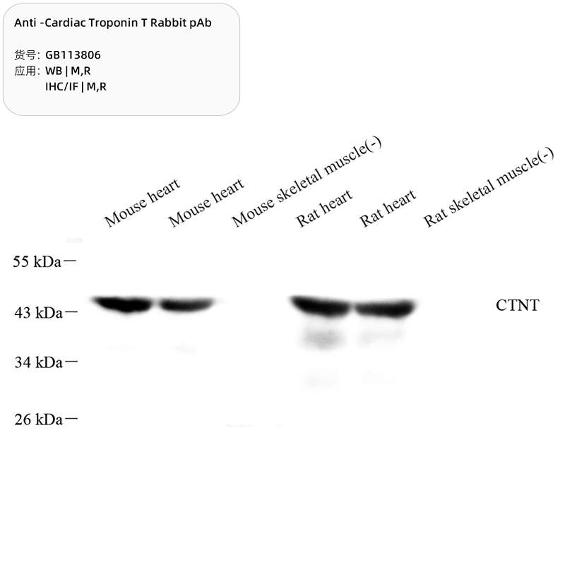 Антитела первичные, поликлональные, Cardiac Troponin T, 100 мкл