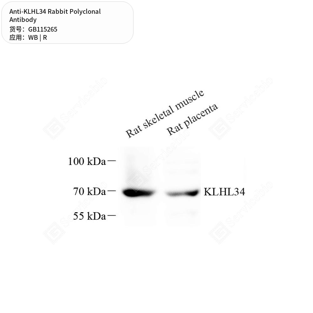 Антитела первичные, поликлональные кролика к KLHL34 крысы, 50 мкл