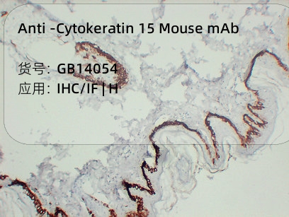 Антитела первичные, моноклональные мыши к Cytokeratin 15 человека, 50 мкл