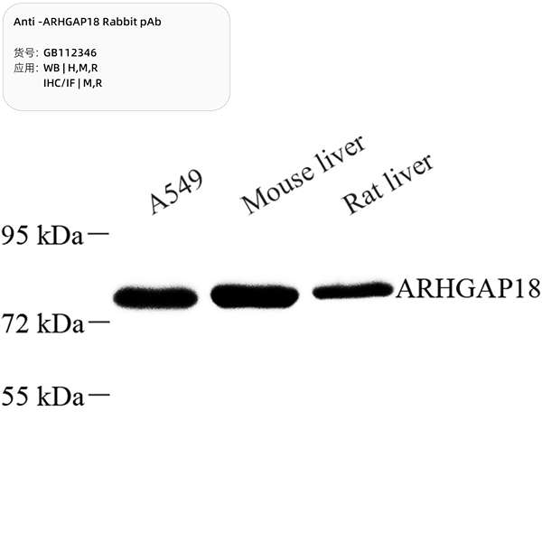 Антитела первичные, поликлональные, ARHGAP18, 100 мкл