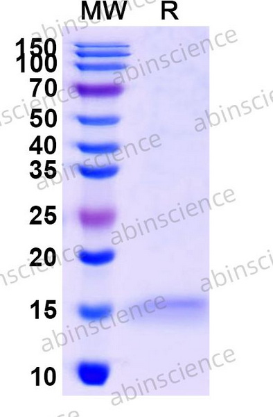 Наноантитела CD66e/CEA/CEACAM5 (SAA0837),100 мкг