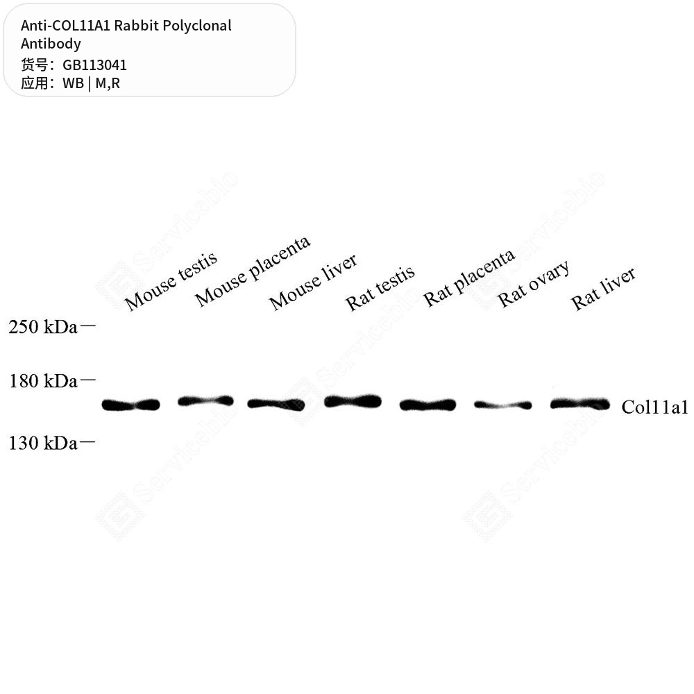 Антитела первичные, поликлональные кролика к COL11A1 крысы, мыши, 100 мкл