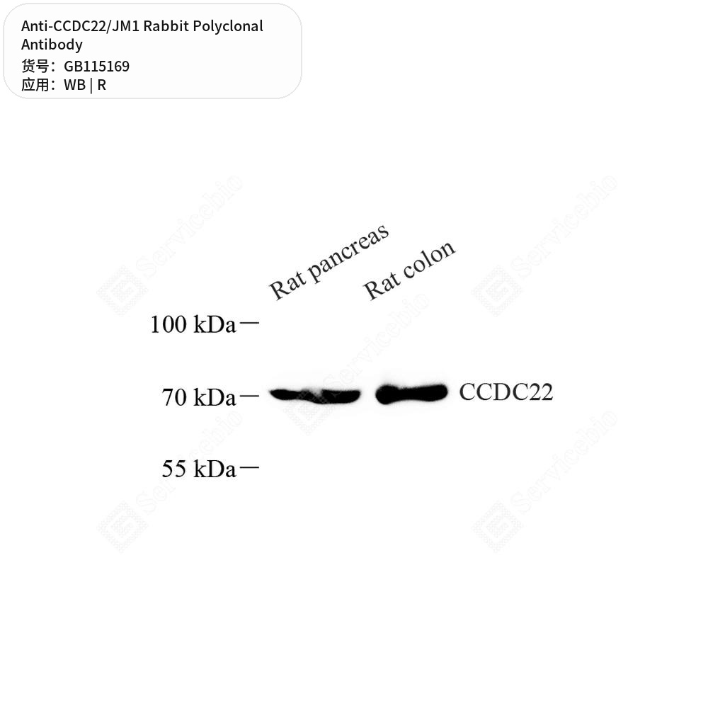 Антитела первичные, поликлональные кролика к CCDC22/JM1 крысы, 50 мкл