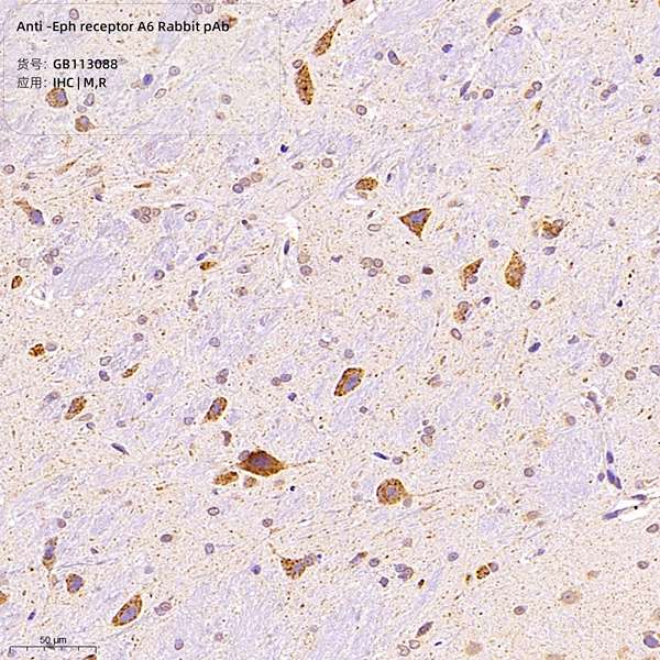 Антитела первичные, поликлональные, Eph receptor A6, 100 мкл