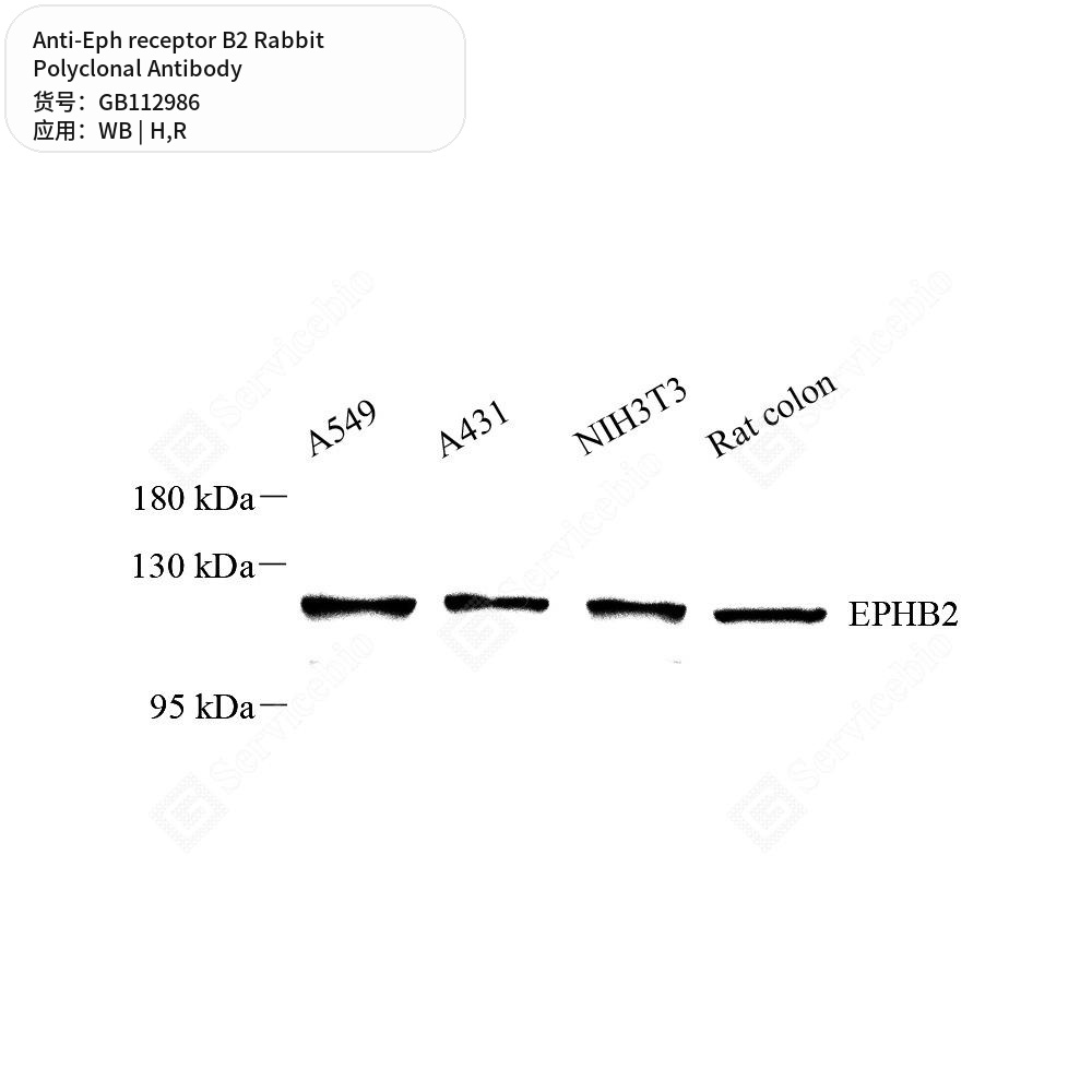 Антитела первичные, поликлональные кролика к Eph receptor B2 крысы, человека, 100 мкл