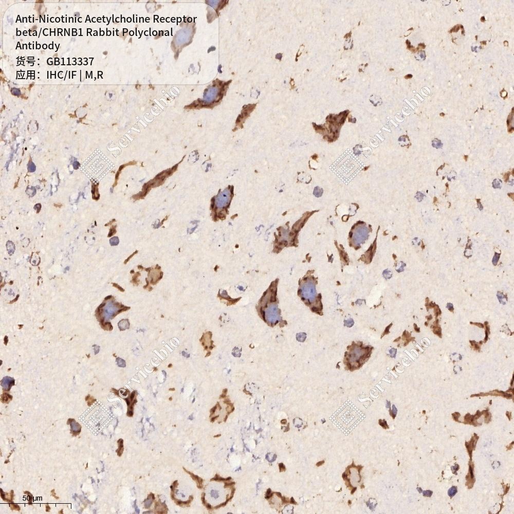 Антитела первичн., полик. крол. к Nicotinic Acetylcholine Receptor beta/CHRNB1 крысы, мыши, 100 мкл
