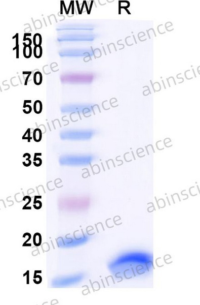 Наноантитела EGFR/ERBB1/HER1 (SAA0792), 100 мкг