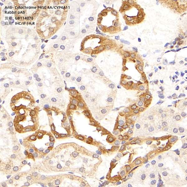 Антитела первичные, поликлональные, Cytochrome P450 4A/CYP4A11, 100 мкл