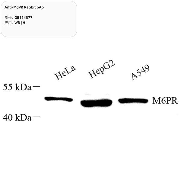 Антитела первичные, поликлональные, M6PR, 100 мкл
