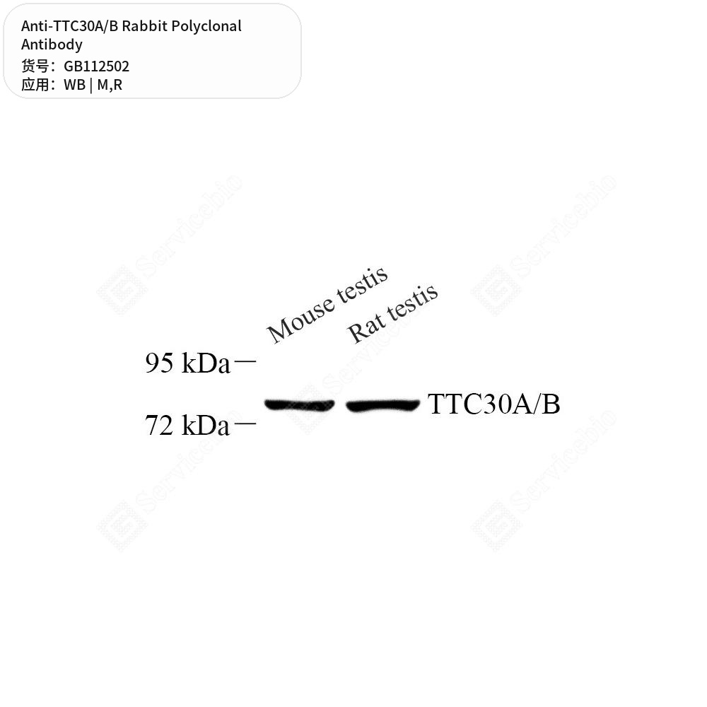 Антитела первичные, поликлональные кролика к TTC30A/B крысы, мыши, 100 мкл