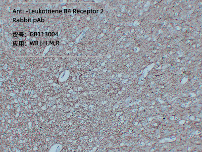 Антитела первичные, моноклональные мыши к 68kDa Neurofilament/NF-L человека, 50 мкл