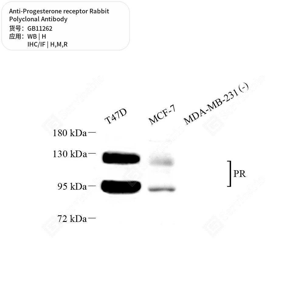 Антитела первичные, поликлональные кролика к Progesterone receptor крысы, мыши, человека, 100 мкл