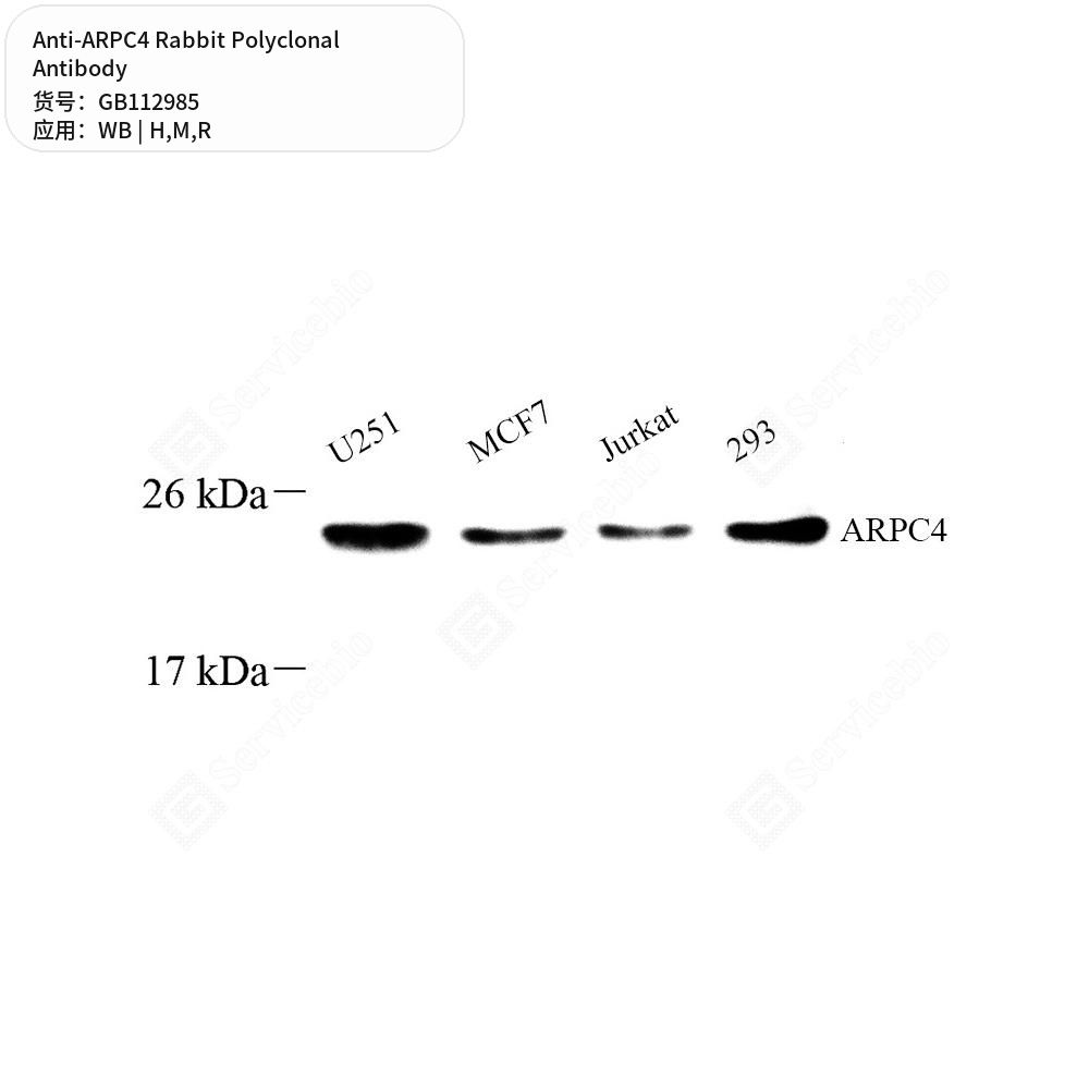 Антитела первичные, поликлональные кролика к ARPC4 крысы, мыши, человека, 50 мкл