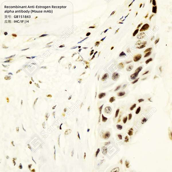 Антитела первичные, моноклональные, Estrogen Receptor alpha, 100 мкл