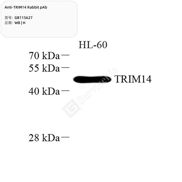 Антитела первичные, поликлональные, TRIM14, 100 мкл