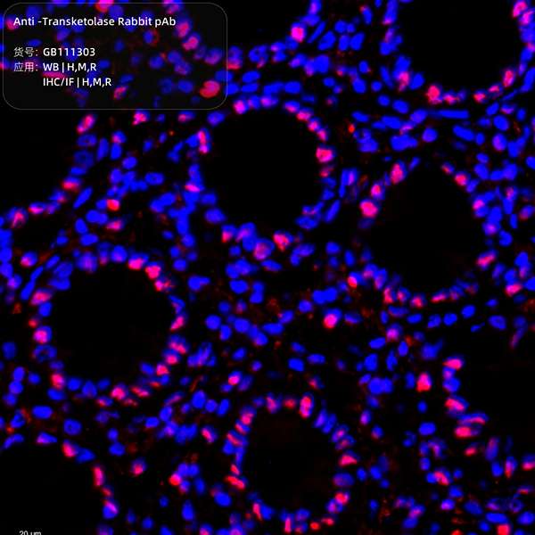 Антитела первичные, поликлональные, Transketolase, 100 мкл