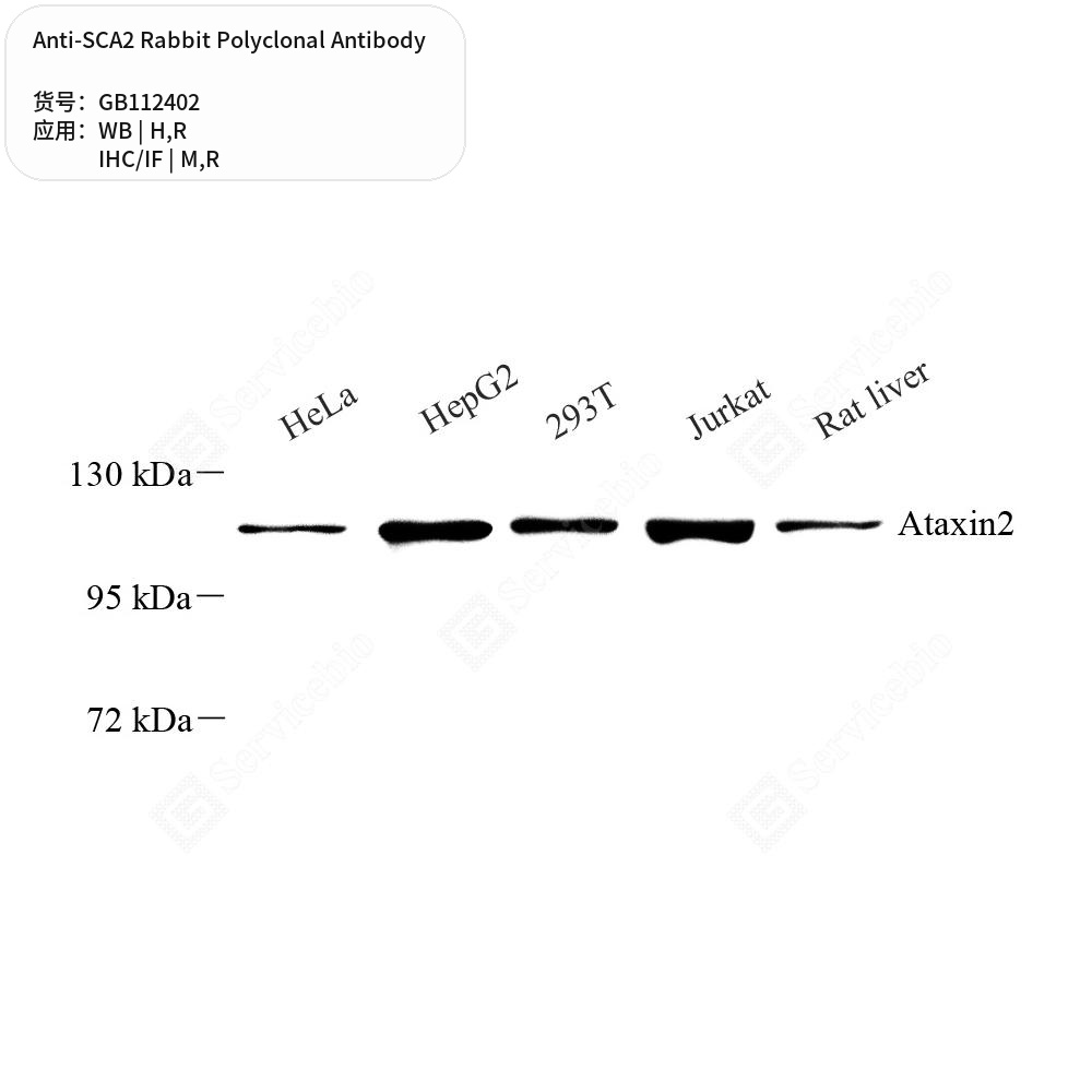 Антитела первичные, поликлональные кролика к SCA2 крысы, мыши, человека, 100 мкл