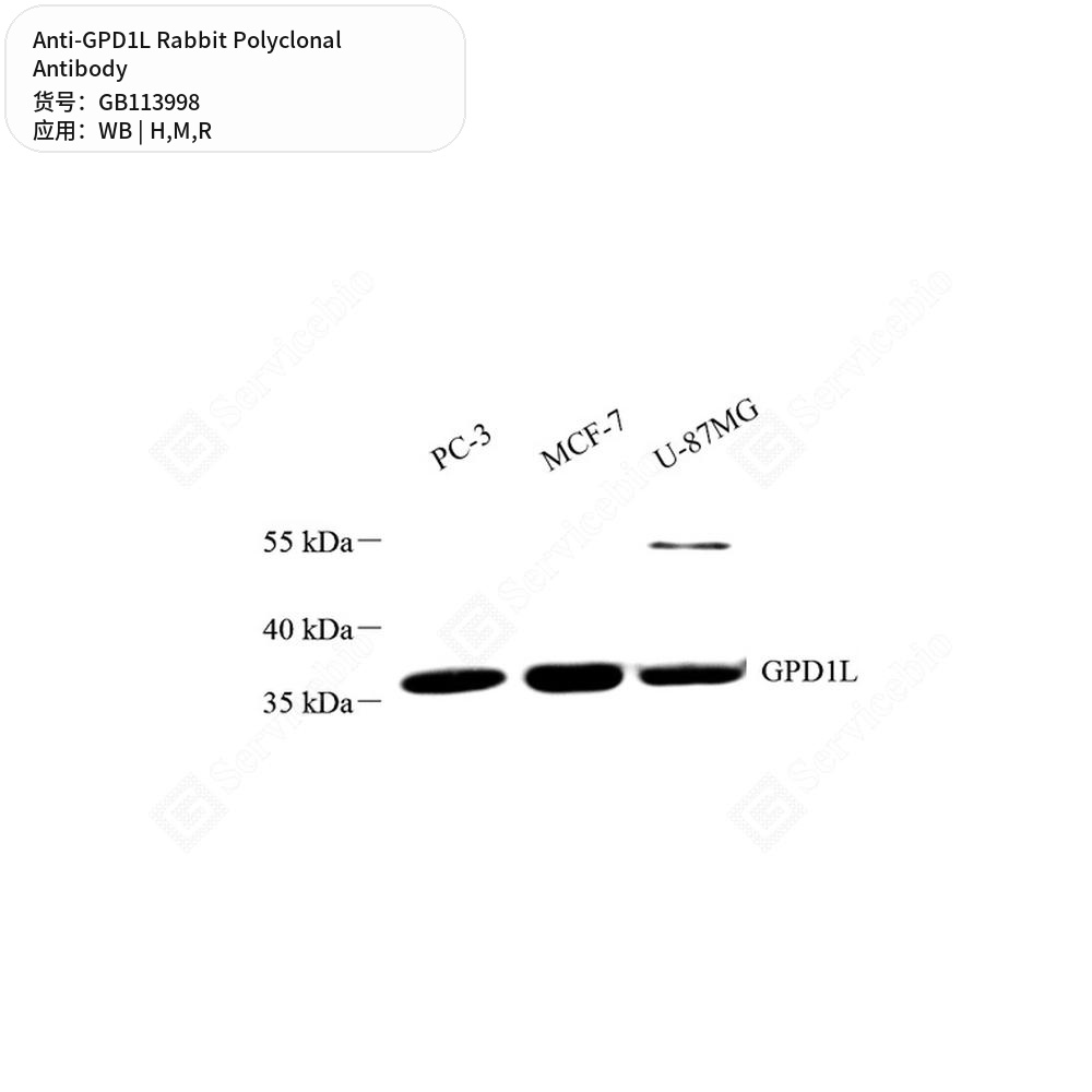 Антитела первичные, поликлональные кролика к GPD1L крысы, мыши, человека, 50 мкл