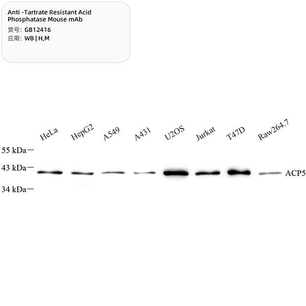 Антитела первичные, моноклональные, Tartrate Resistant Acid Phosphatase, 100 мкл