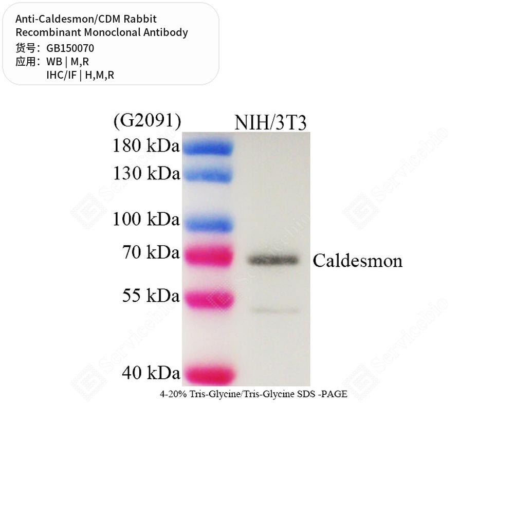 Антитела первичные, моноклональные кролика к Caldesmon/CDM крысы, мыши, человека, 50 мкл