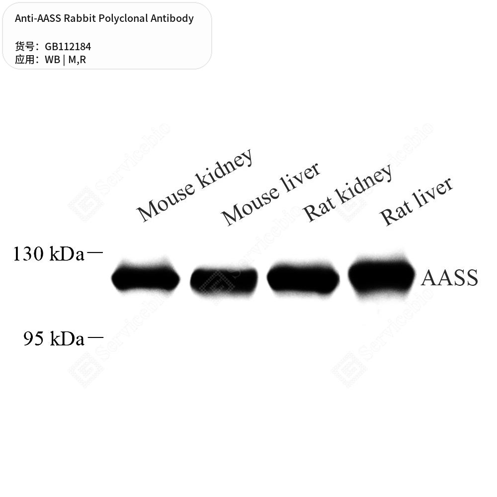 Антитела первичные, поликлональные кролика к AASS крысы, мыши, 100 мкл