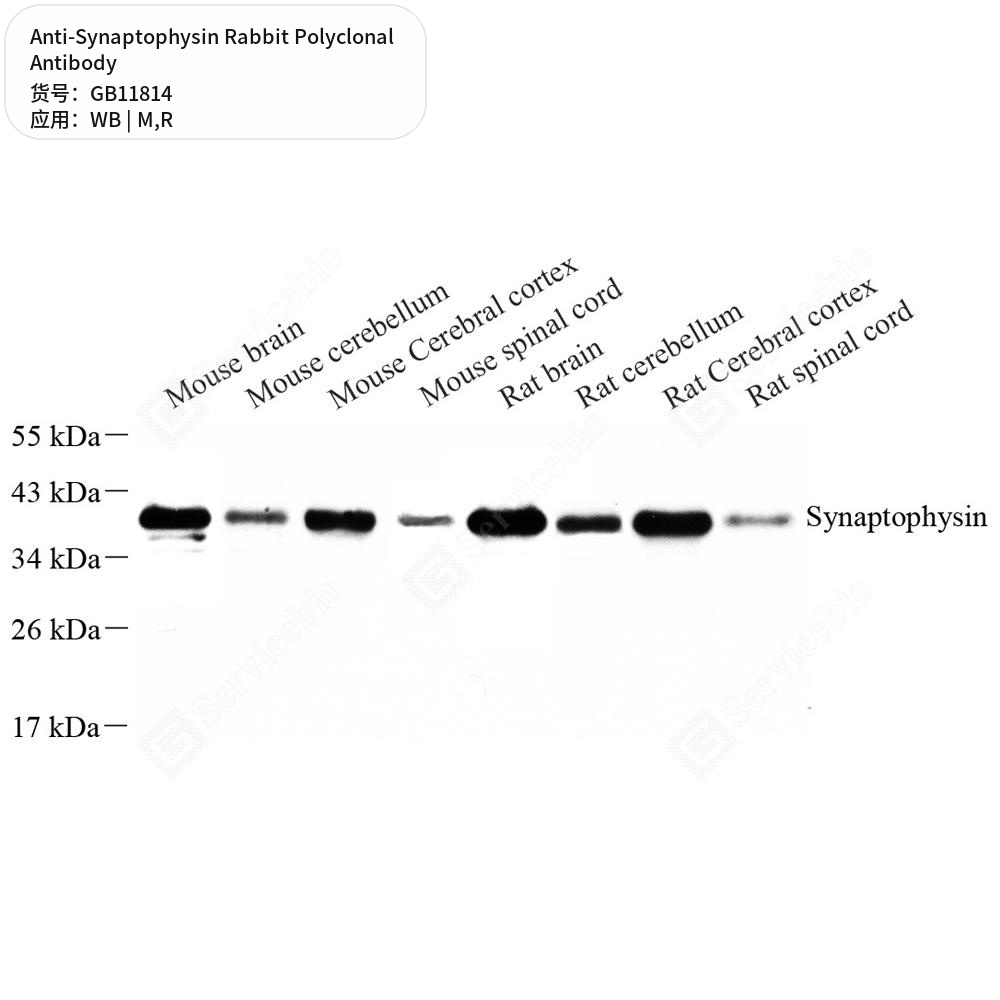 Антитела первичные, поликлональные кролика к Synaptophysin крысы, мыши, 50 мкл